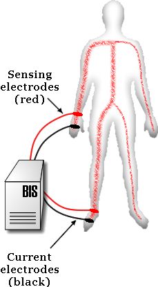 bia schematic