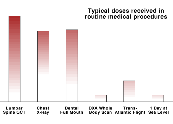 Medical radiation dose chart