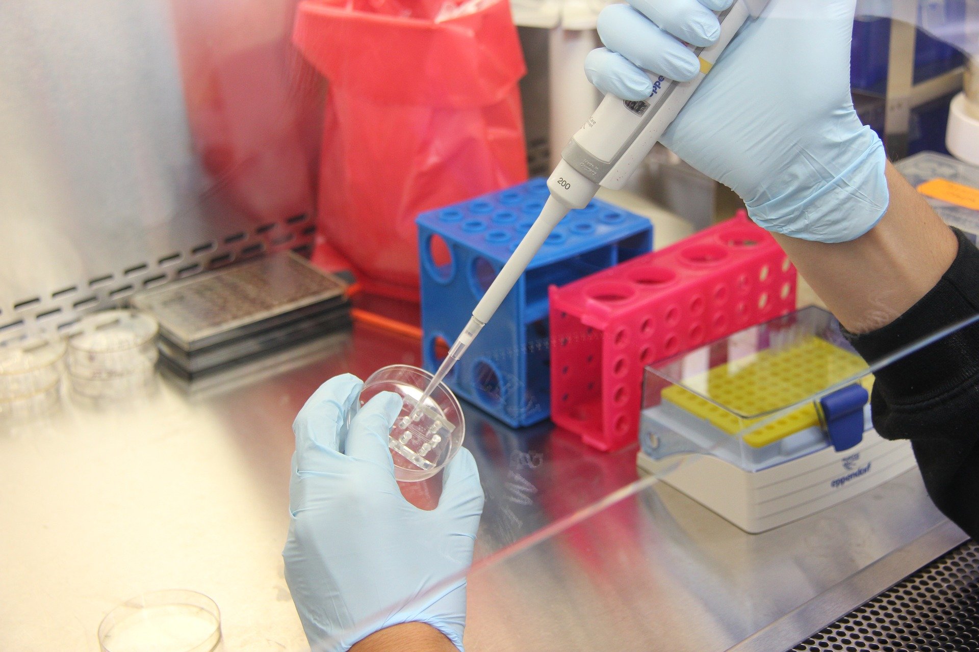 Mouse model closely reproduces human fatty liver disease | BCM