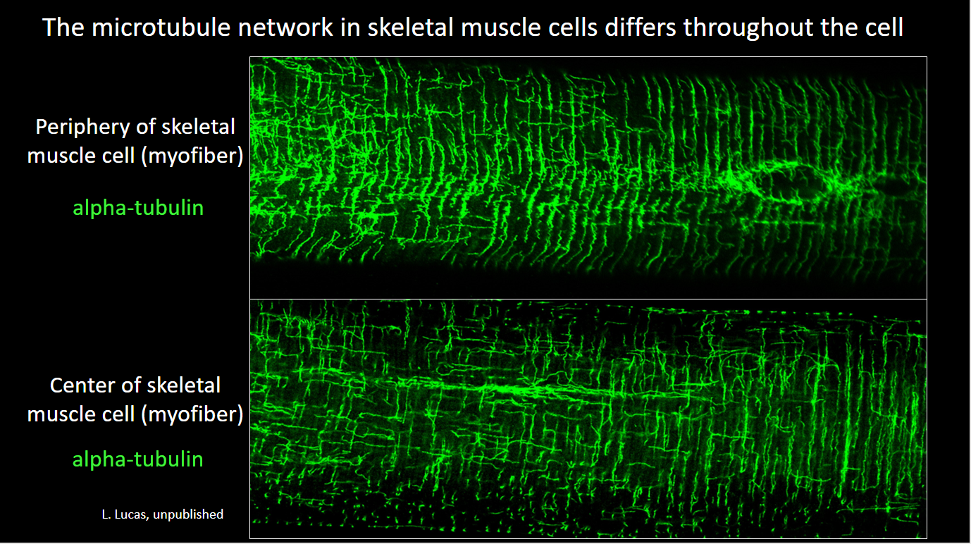 The microtubule network in skeletal muscle cells differs throughout the cell.