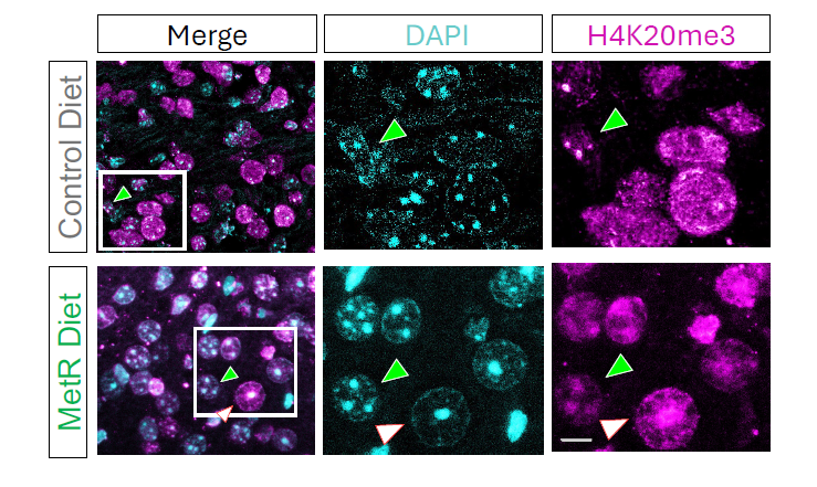 Diet remodels chromatin structure and extends survival in models of glioma