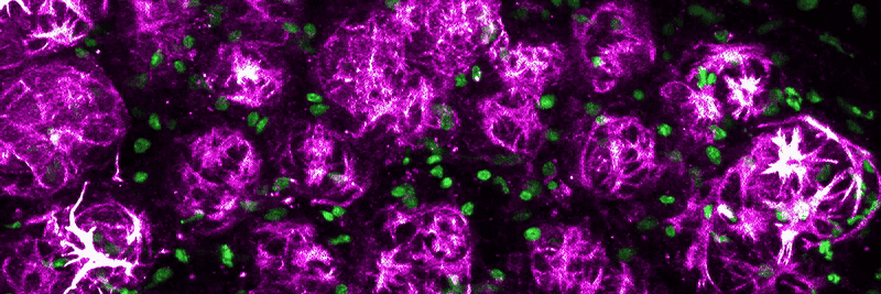 lactating mammary gland