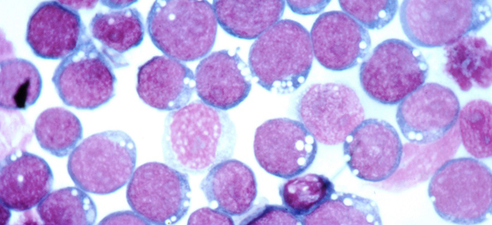 Magnified view of the Epstein-Barr Virus