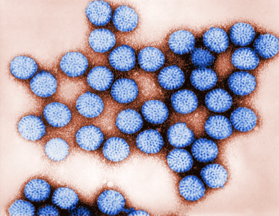 This 1981 digitally-colorized transmission electron microscopic (TEM) image revealed some of the ultrastructural morphology of a number of intact rotavirus, double-shelled particles.