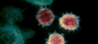 This transmission electron microscope image shows SARS-CoV-, also known as 2019-nCoV, the virus that causes COVID-19