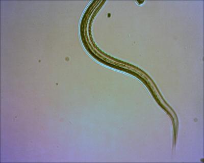 Hookworm