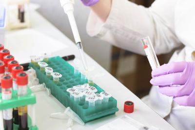 Photo of hands in purple gloves using a pipette in a lab sorting liquid samples.