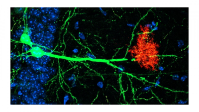 Image depicting Neurons (green) and astrocytes (red) work together to regulate storage and retrieval of memories