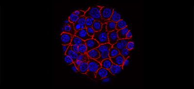 This image shows pancreatic cancer cells (nuclei in blue) growing as a sphere encased in membranes (red). Courtesy of the National Cancer Institute