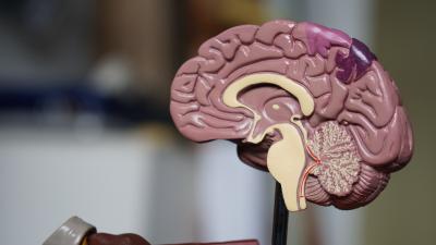 Researchers find regulator for brain injury's first responders
