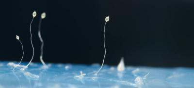 Fruiting bodies of the social amoeba, dictyostelium discoideum.