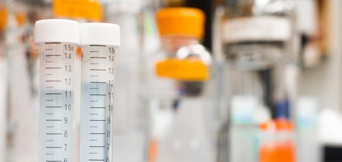 test tubes in a research lab