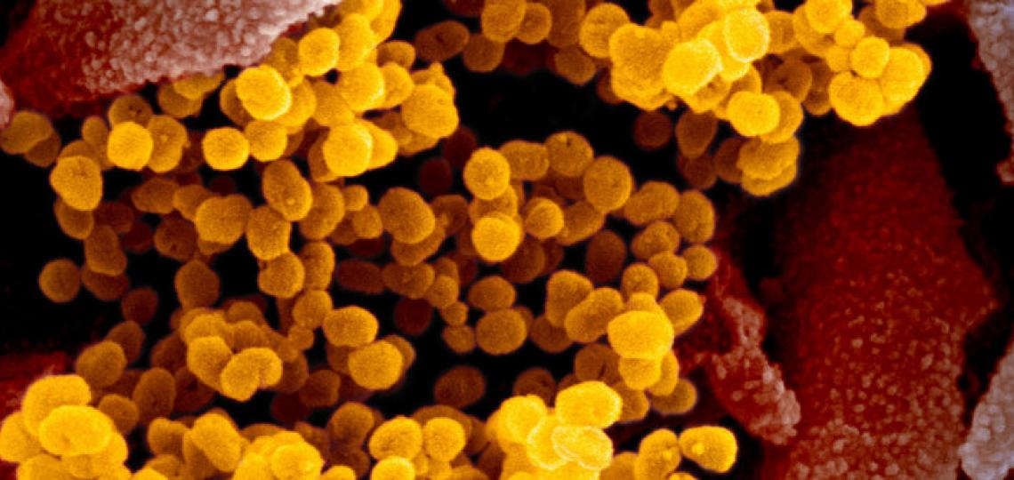 Coronavirus Preparedness
