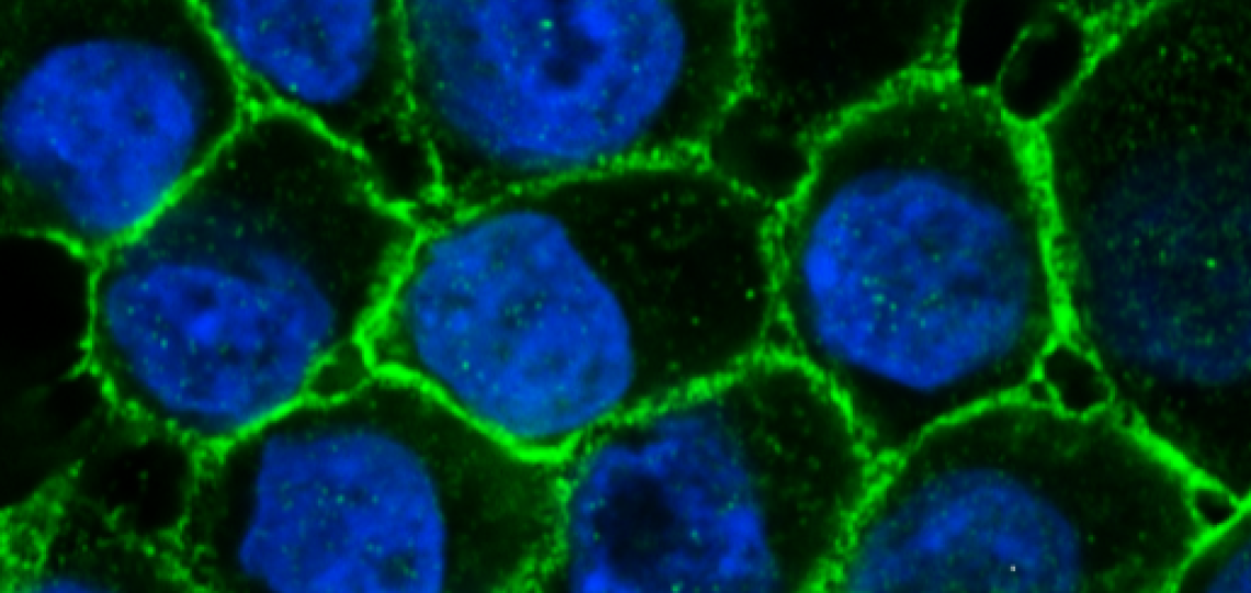 Human breast epithelial cells 
