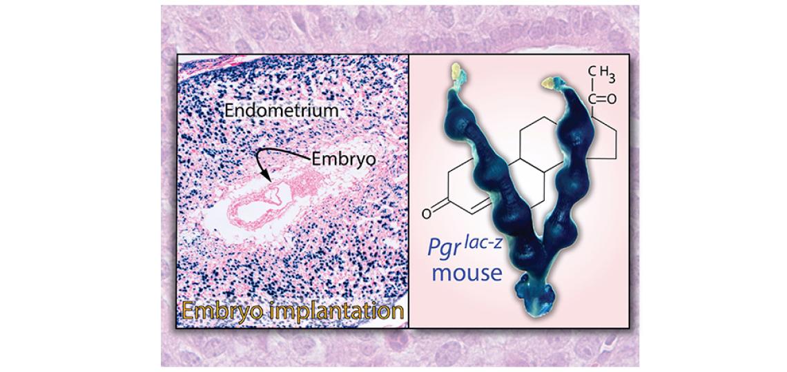 Progesterone Receptor Expression