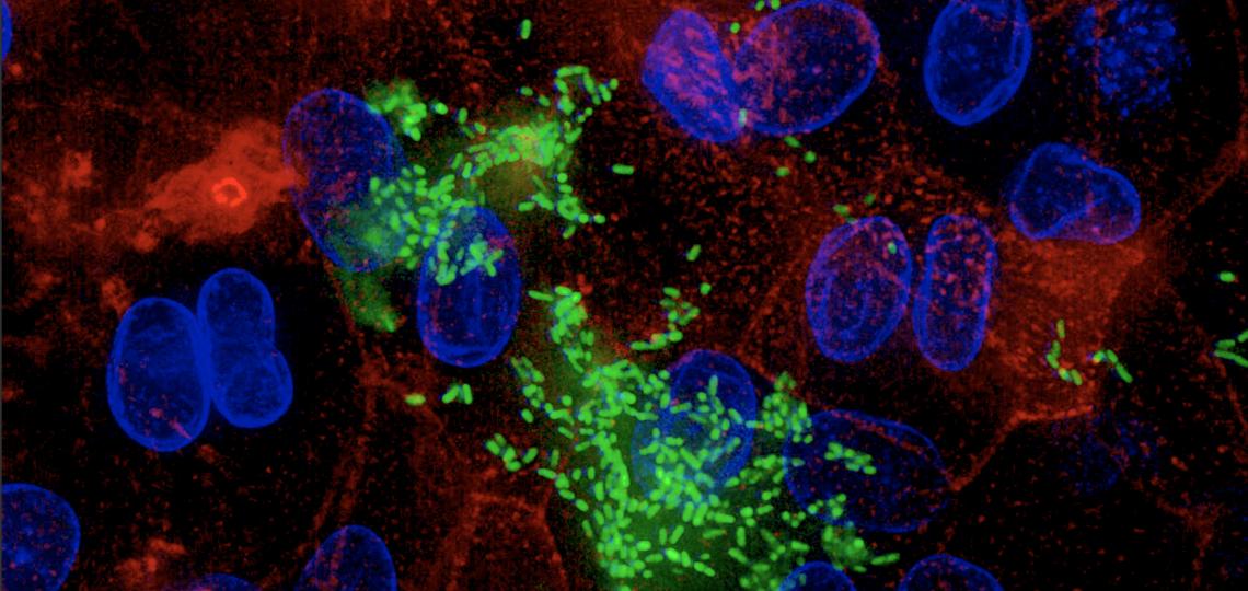 Image from Maressa Lab