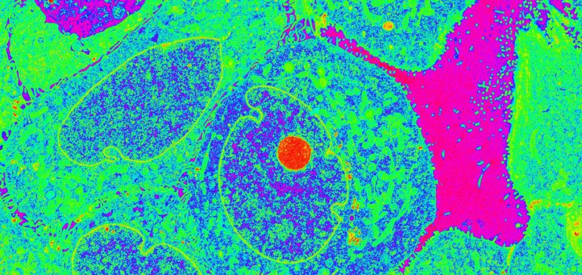 R19-58A-1-MITO-01_modified3