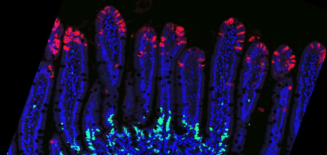 Murine enterocytes infected with murine rotavirus. 