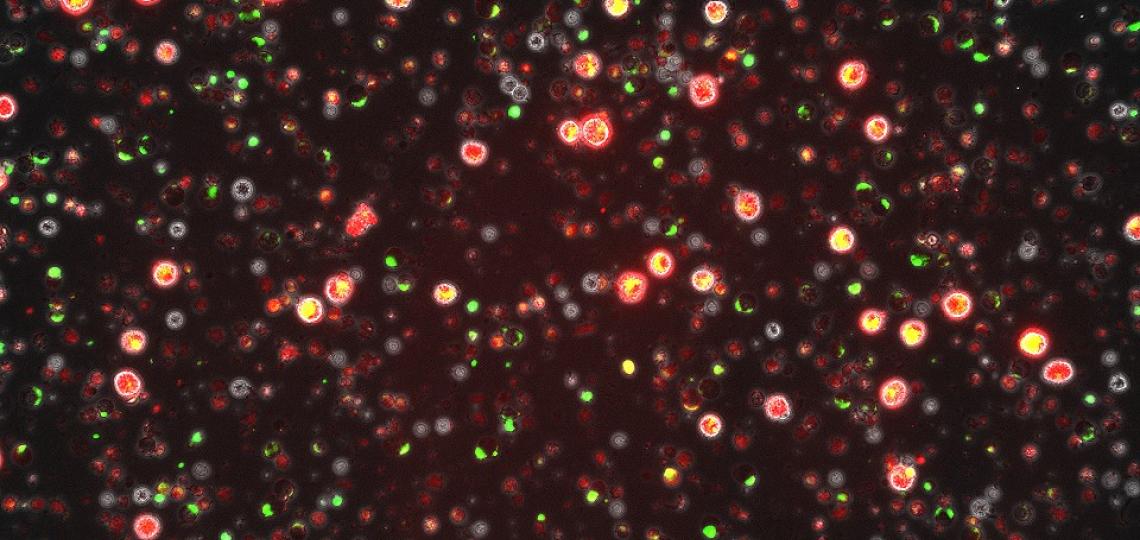 Pediatric Surgical Oncology Laboratory 