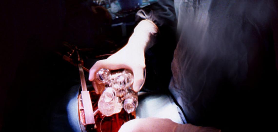 OH Frazier, M.D. implanting an artificial heart.