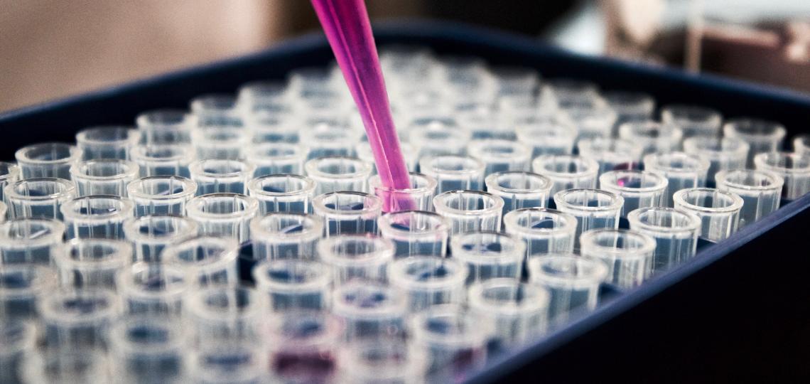 Image of pipette and test tubes