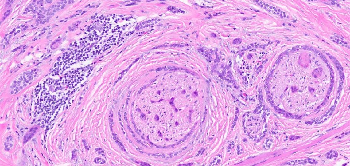 Dermatopathology (Multidisciplinary) Fellowship 