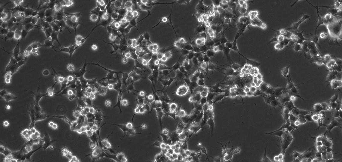 Neurosurgery Glioma Cell