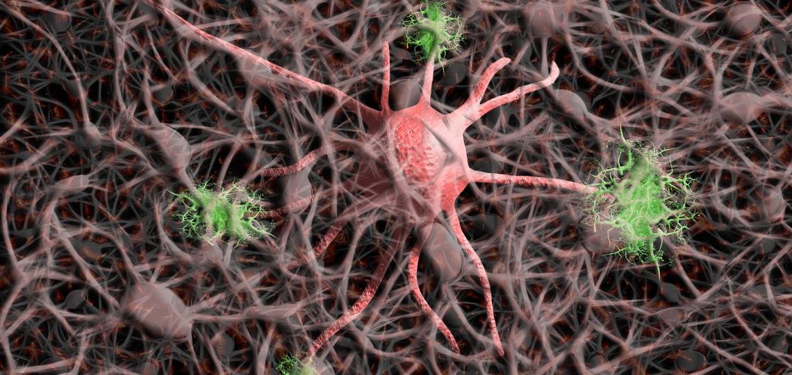 Drawing of synapses.