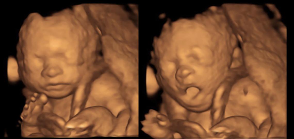 Fellow Research OBGYN