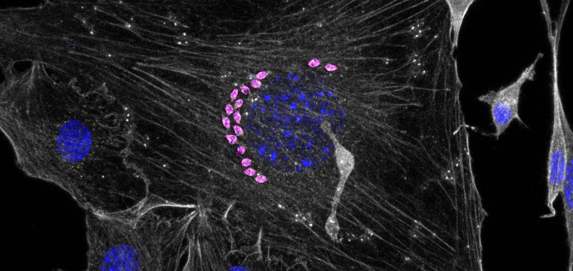 parasitic stage of protozoan Trypanosoma cruzi