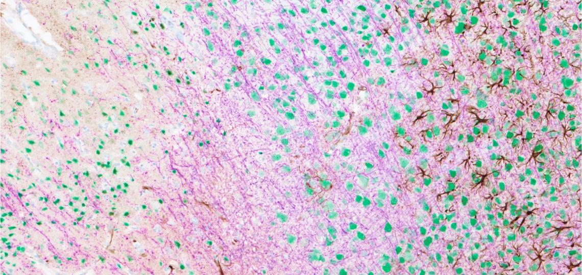 Mouse cells after a stroke