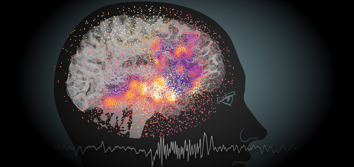 Stylized photo of a brain