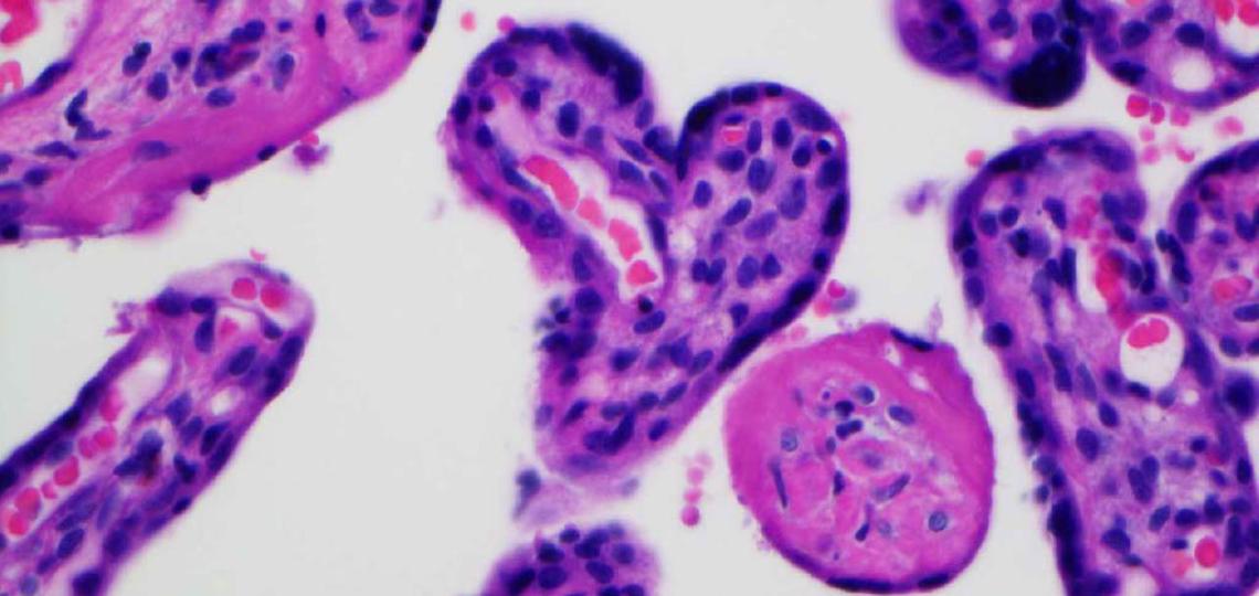 placenta heart