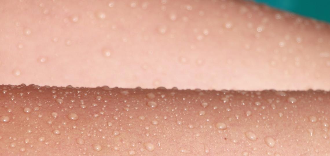 Close up photo of sweat on skin.