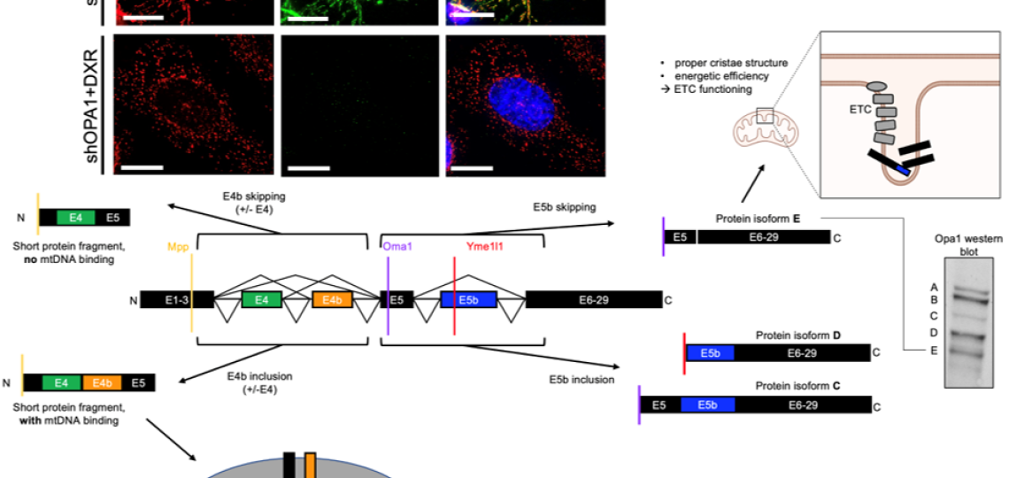image of mitochondrial fusion protein OPA1 driving mitochondrial fusion-promoted oxphos and chemotherapy resistance in TNBC