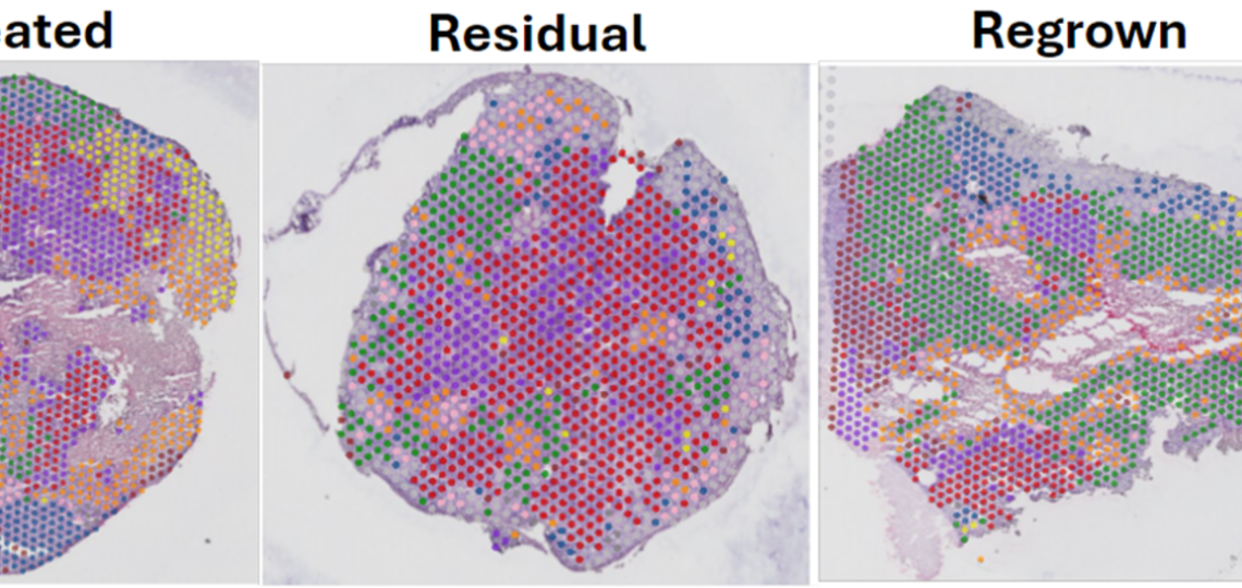image showing spatial transcriptomic and metabolomic technologies