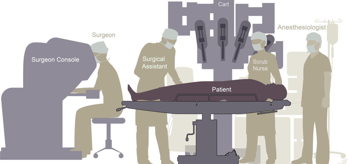 Illustration of a robotic thoracic surgery setup. A patient lies on an operating table surrounded by medical staff and robotic equipment. On the left, a surgeon sits at a large console labeled "Surgeon Console," controlling robotic arms from a distance. Near the patient, a "Surgical Assistant" stands on the left, while a "Scrub Nurse" stands on the right. Behind them is the "Patient Cart," which holds robotic surgical arms positioned above the patient. An "Anesthesiologist" stands near the patient’s head, n