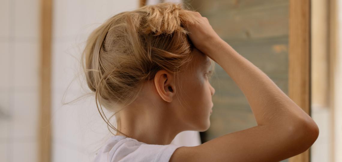 A photo of a girl holding her hair up because her head itches. She has lice! 