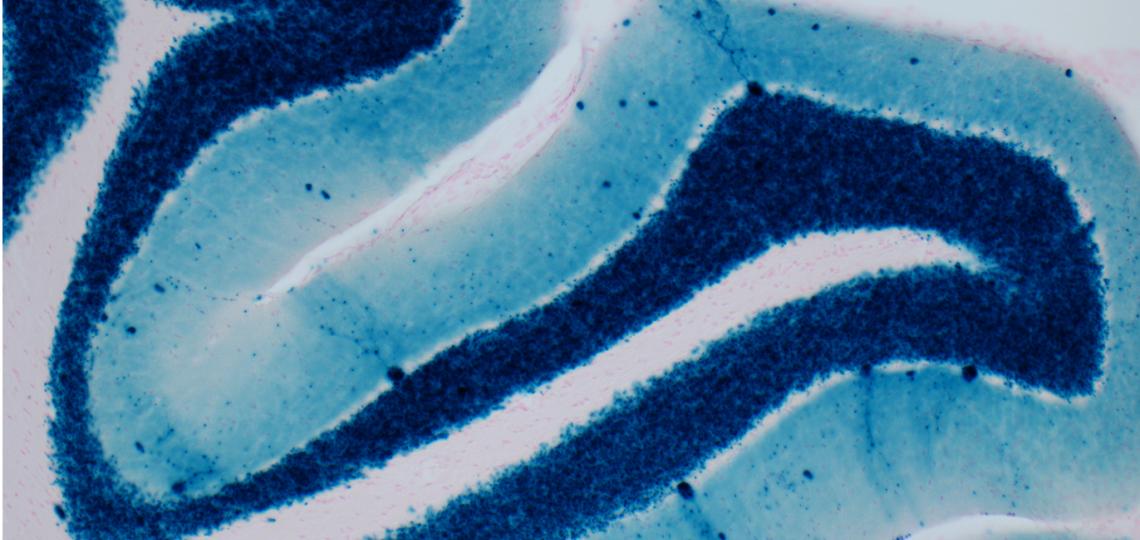 LacZ staining on cerebellar tissue from Sun et al. JCN 2014