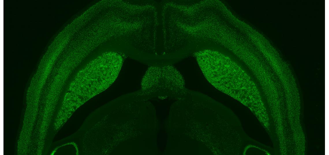 A GFP reporter line was used to visualize transgene expression in CaMKII-tTA mice.