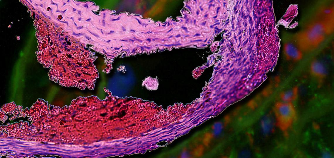 Copyrighted image used with permission by Surgery