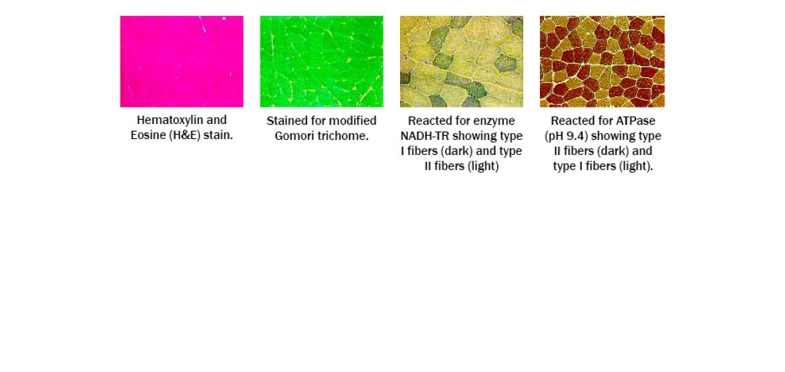 Cross-Section of a Normal Muscle