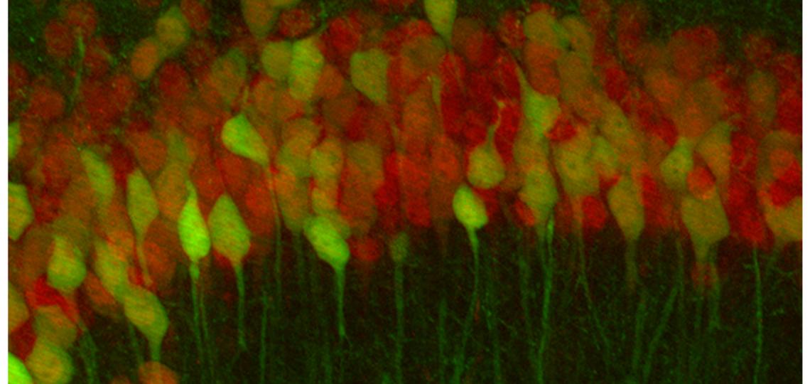 Co-injection of AAV expressing either YFP or tdTomato into the neonatal mouse brain produces mosaic expression in the adult.