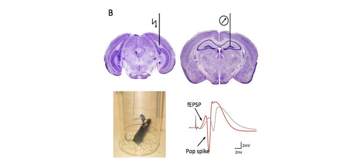 IDDRC Neurophysiology Core
