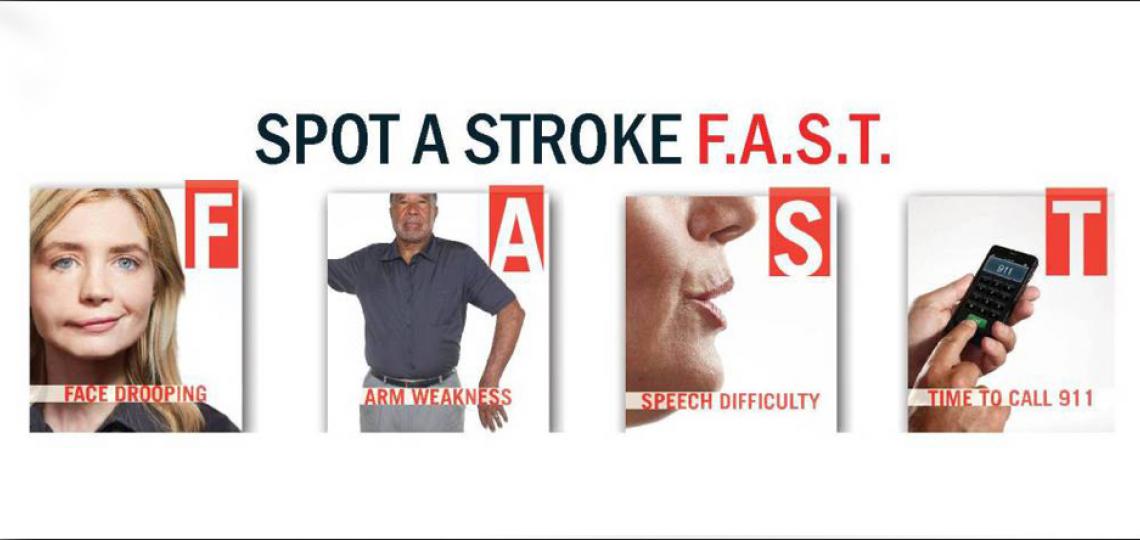 Acute Ischemic Stroke Baylor Medicine தமிழ் tamiḻ t̪amiɻ, pronunciation ) is a dravidian language natively spoken by the tamil people of south asia. acute ischemic stroke baylor medicine