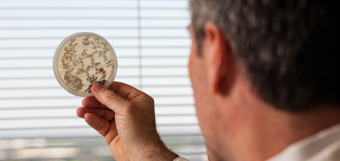 Fungus in Petri dish