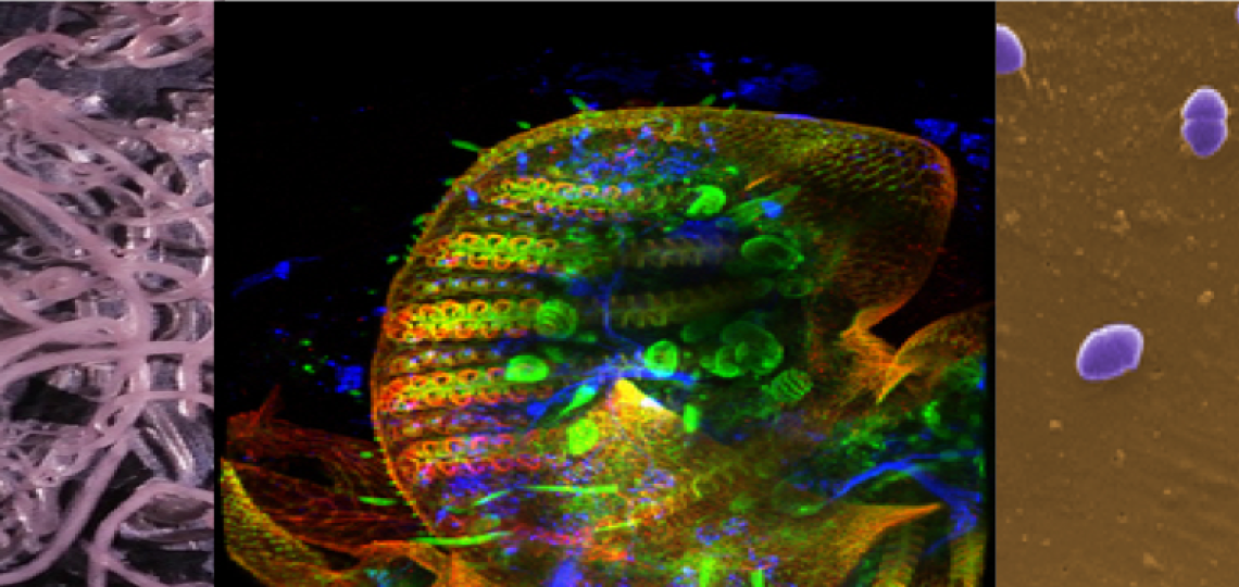 Hookwork, fruit fly and bacteria
