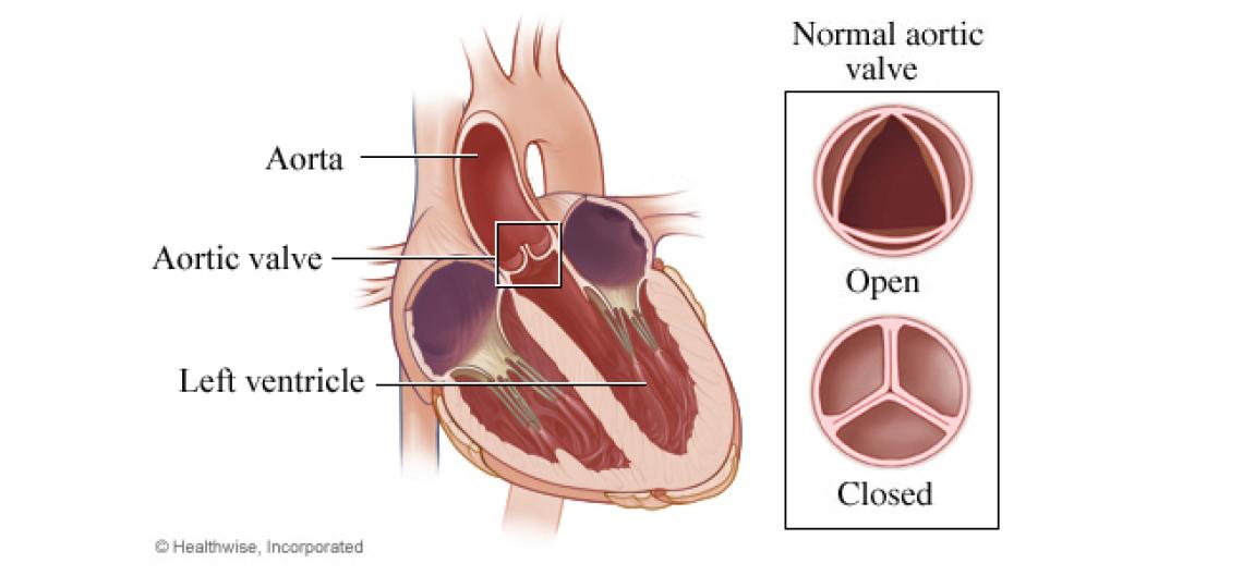Aortic valve