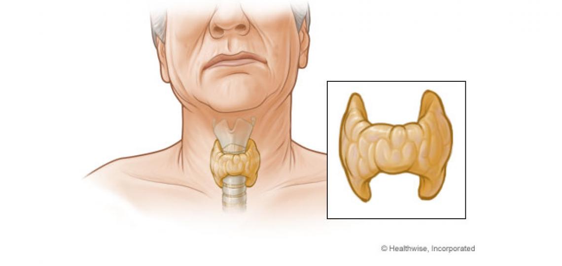 Thyroidectomy