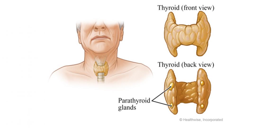 Parathyroidectomy